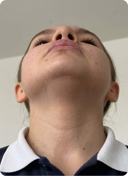 After using eekoHome