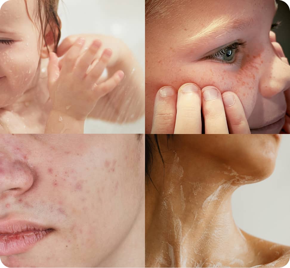 Works Across Every Skin Concern