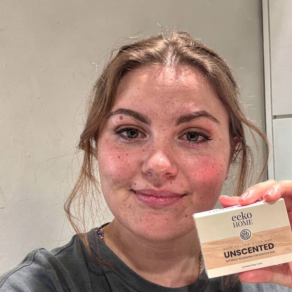 Dry skin before eekoHome
